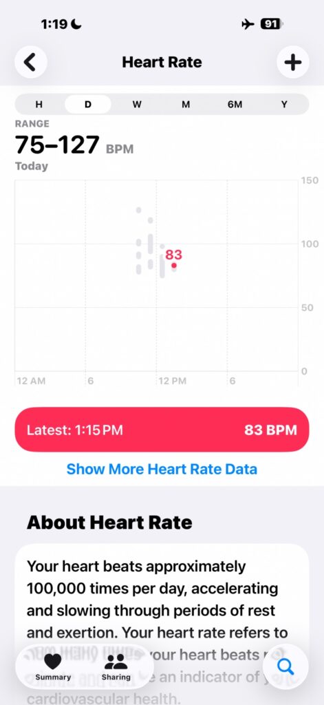 Screenshot of blood pressure readings logged in Apple Health—systolic and diastolic trends tracked alongside Apple Watch metrics like heart rate and ECG.