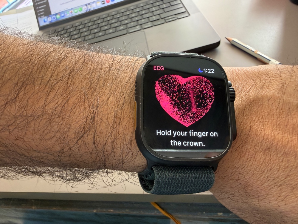 Apple Watch on Dr. Manav Verma’s wrist displaying ECG heart health —a dentist and swimmer dad using wearable tech for preventive care.