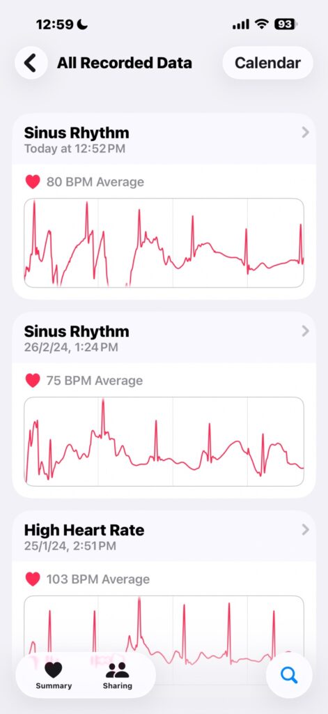 Apple Health app on iPhone showing all recorded morning health metrics sinus rhythm —captured from the Apple Watch during the ECG phase of the day.
