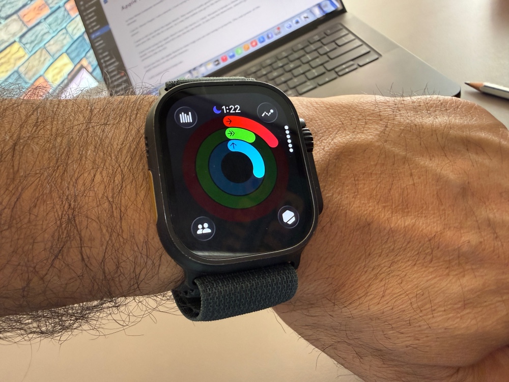 Apple Watch on Dr. Manav Verma’s wrist displaying ECG heart health data—a dentist and swimmer dad using wearable tech for preventive care.